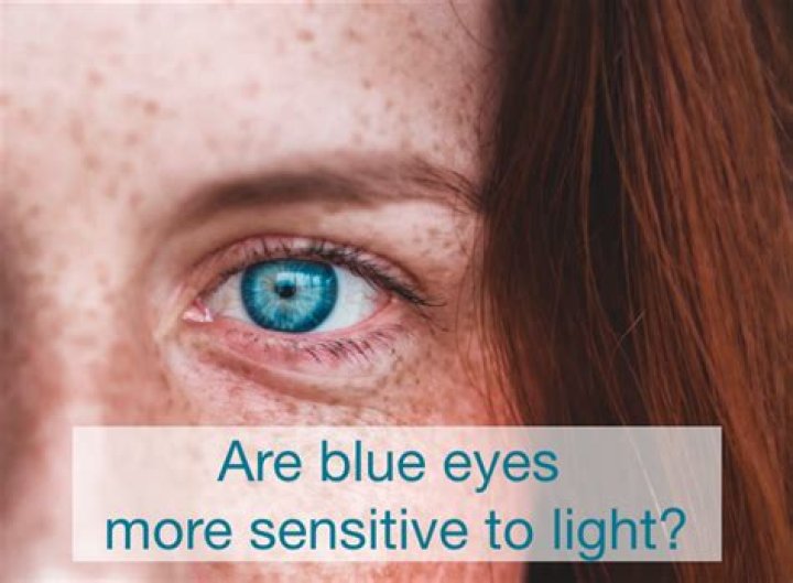 Are blue eyes actually clear?