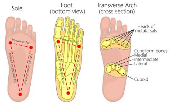 Are fallen arches and flat feet the same thing?