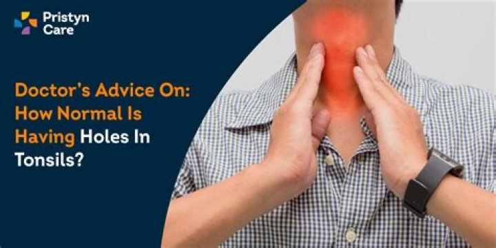 Are holes in grout normal?