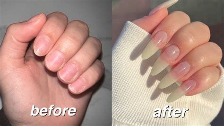 Are Long nails unhygienic?