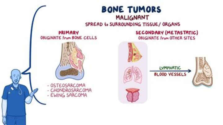 Are most tumors benign?
