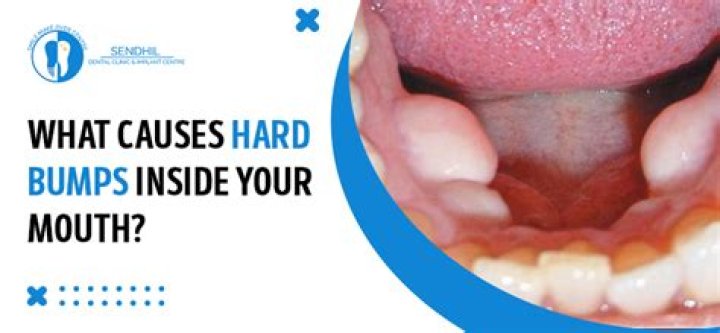 Are small bumps in mouth normal?