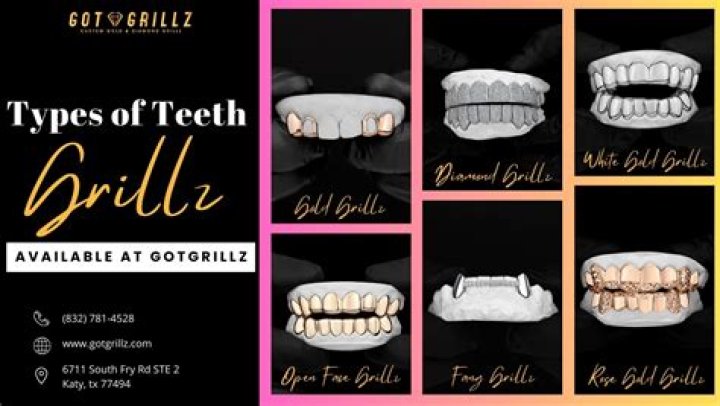 Are teeth grills permanent?