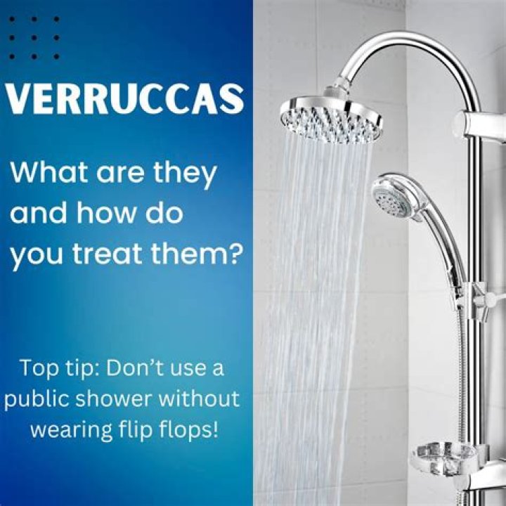 Are verrucas caused by HPV?