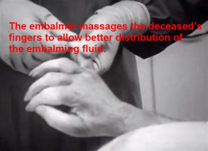 Are you embalmed before cremation?