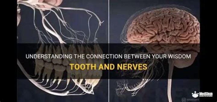 Are your wisdom teeth connected to your heart?