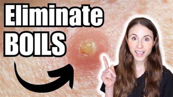 Can a boil be filled with blood?