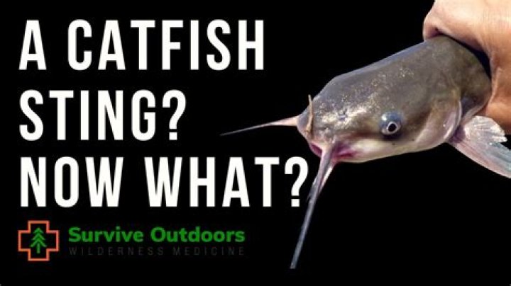 Can a catfish sting make you sick?