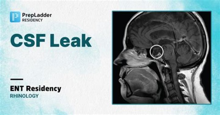 Can a CSF leak affect your heart?
