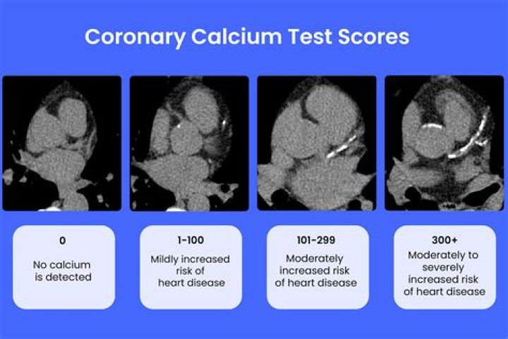Can a CT scan show heart problems?