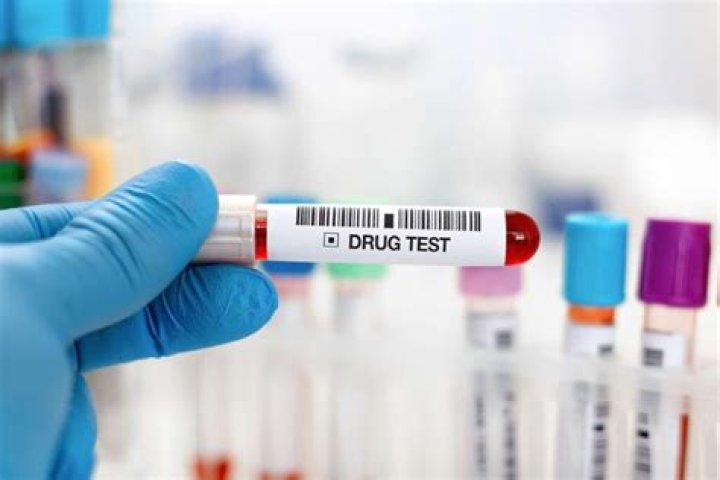 Can a diluted drug test still be positive?