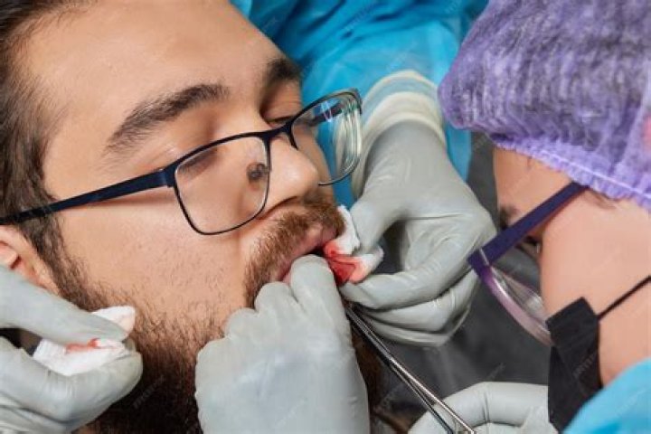Can a lion tongue rip your skin?