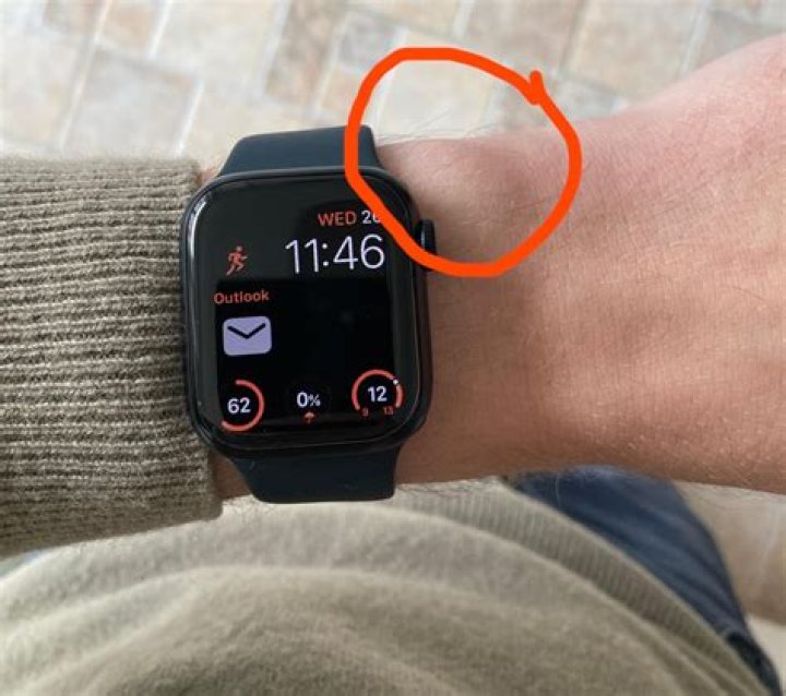 Can a person with a pacemaker wear an Apple Watch?