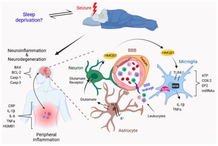 Can a shower trigger a seizure?