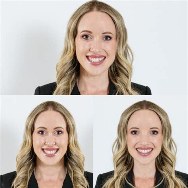 Can a stroke just affect your face?