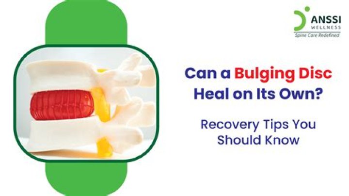 Can a tumor be mistaken for a bulging disc?