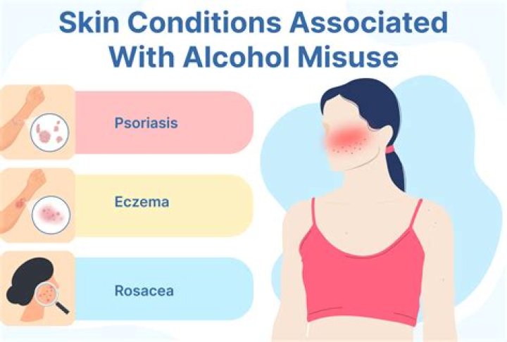 Can alcohol cause skin rashes?