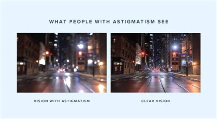 Can an astigmatism cause a lazy eye?