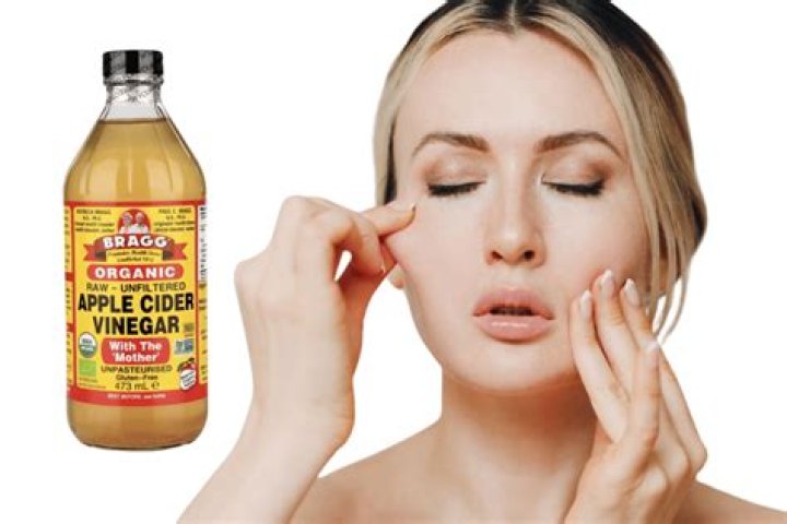 Can apple cider vinegar damage your face?