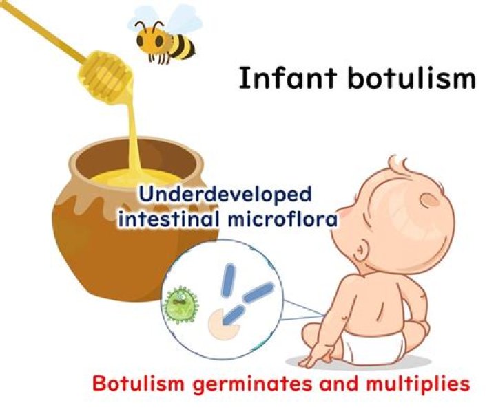 Can babies get botulism from beeswax?