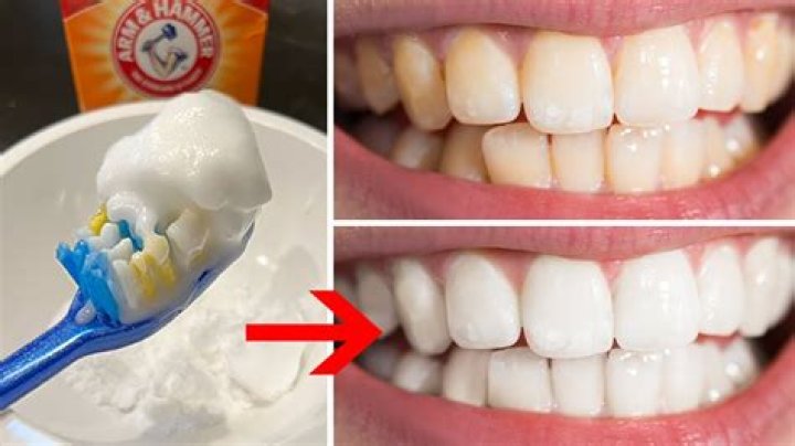 Can chewing gum make your teeth whiter?