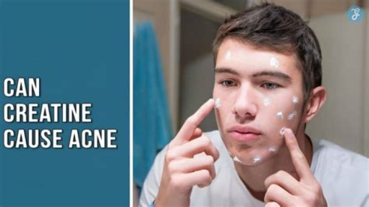 Can Creatine cause pimples?