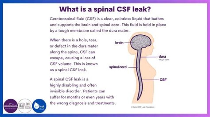 Can CSF leak cause death?