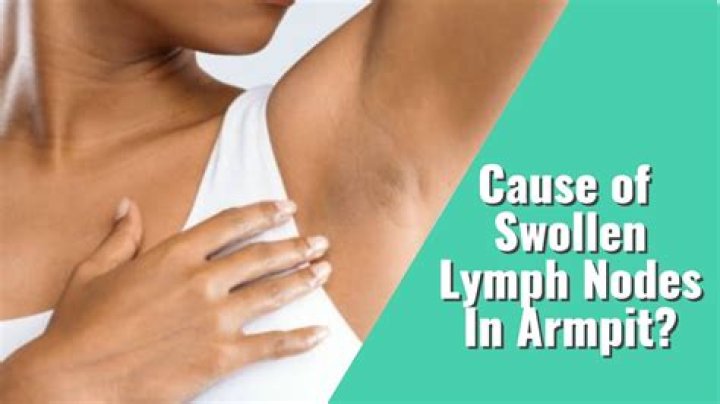 Can deodorant cause lymph nodes to swell?