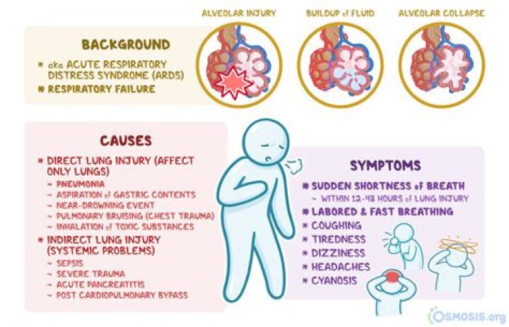 Can epoxy hurt your lungs?