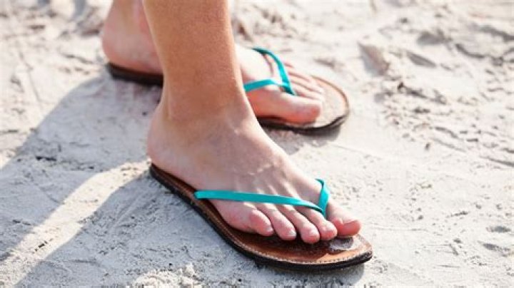 Can flip flops cause flat feet?