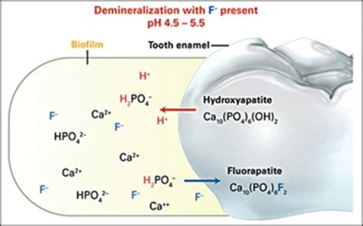 Can fluoride irritate gums?