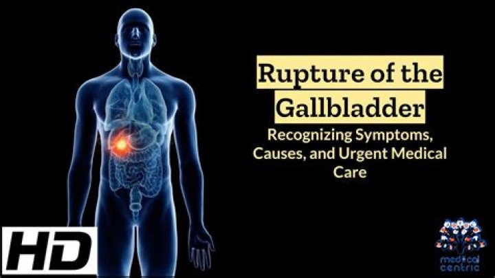 Can gallbladder rupture cause death?