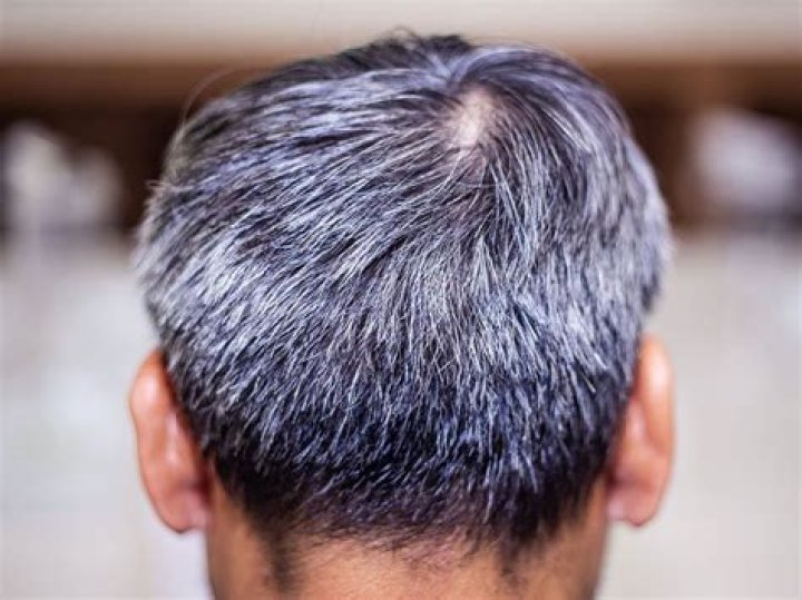 Can GREY hair grow back dark?