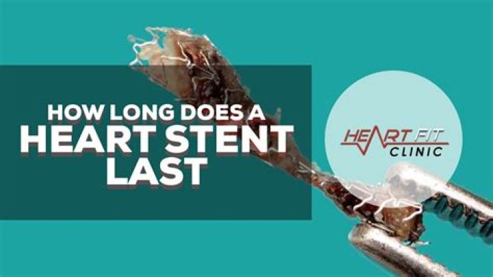 Can heart stents last 20 years?