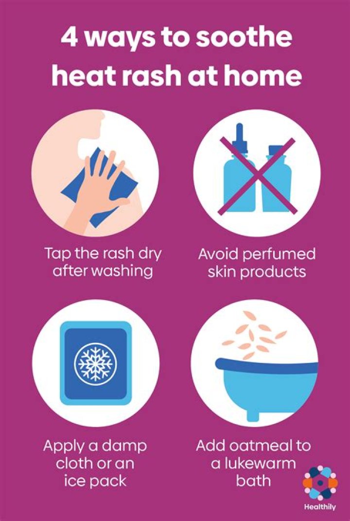 Can heat rash last for days?