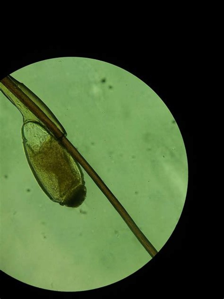 Can humans get fleas in pubic hair?