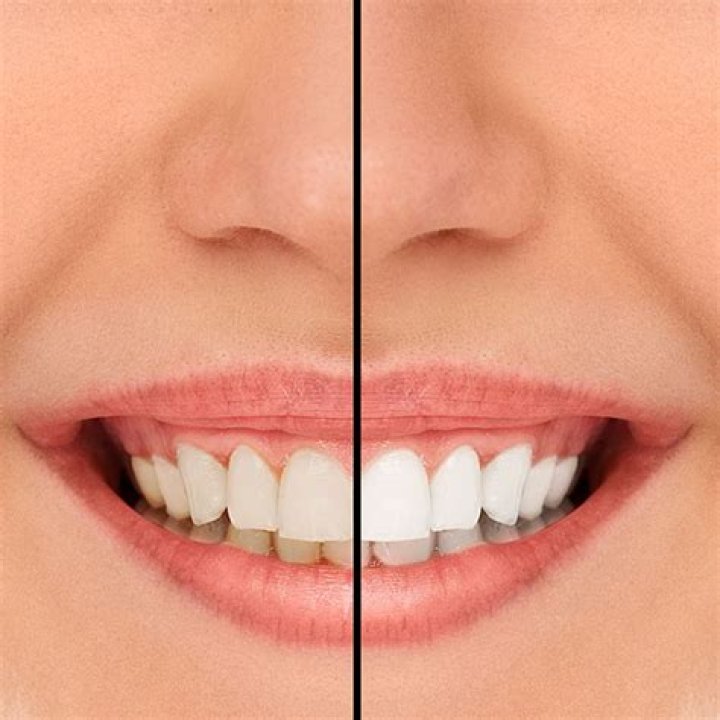 Can I make my teeth healthy again?