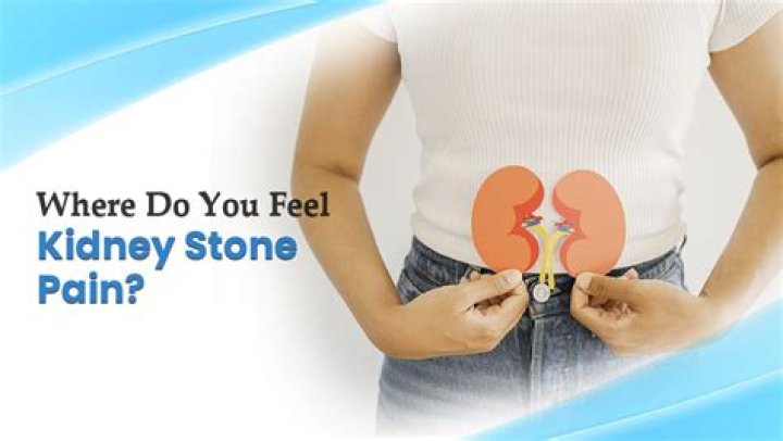 Can kidney stones feel like gas pain?