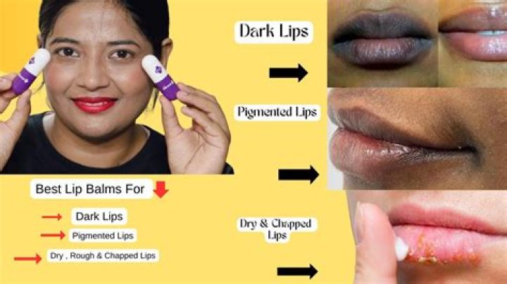Can kojic acid lighten lips?
