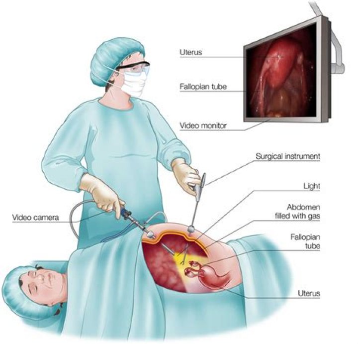 Can laparoscopy cause death?