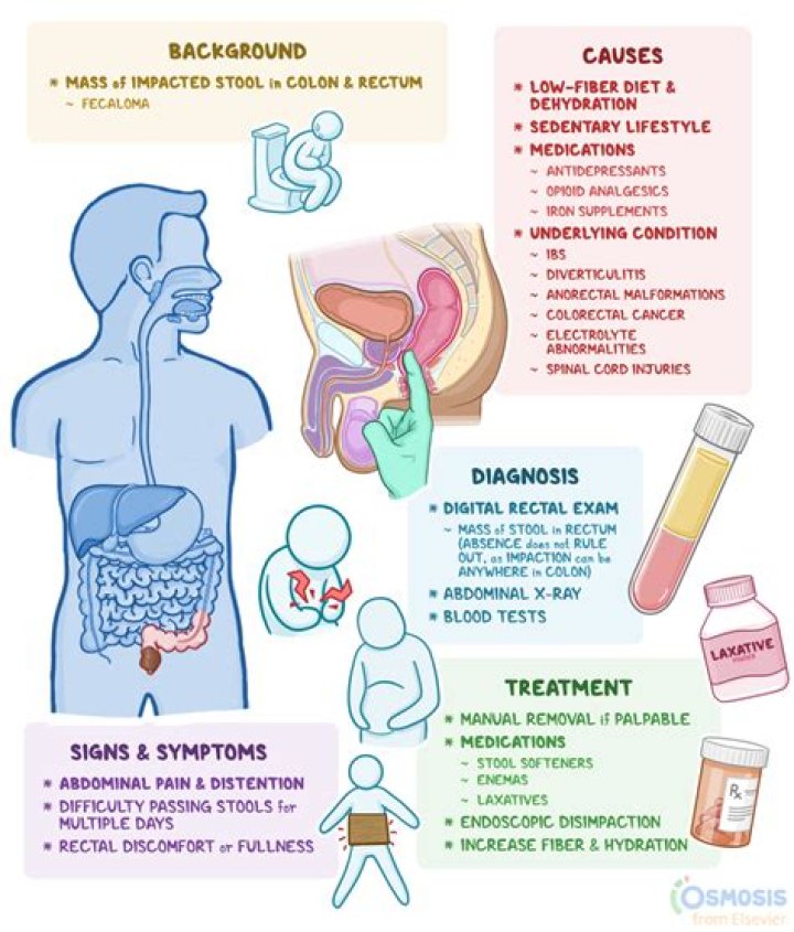 Can laxative cure fecal impaction?