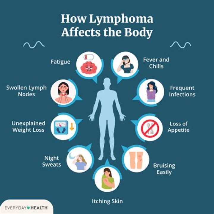 Can lymphoma affect bowel movements?