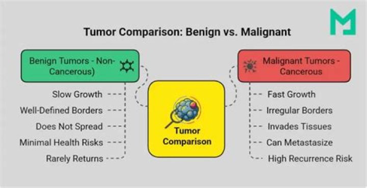 Can neurofibroma turn malignant?