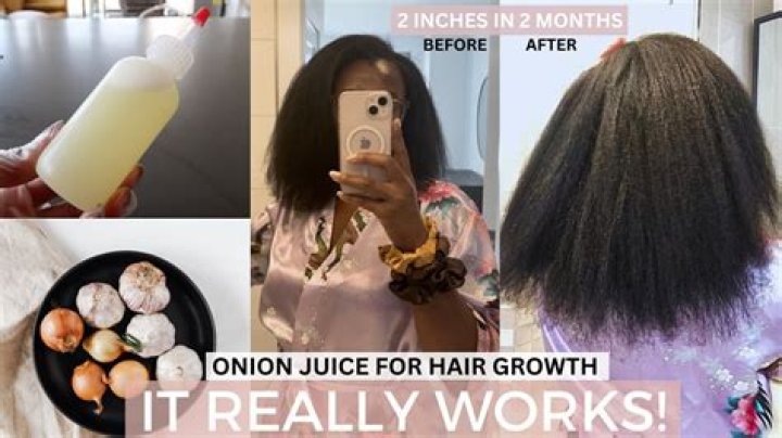 Can onion juice make hair black?