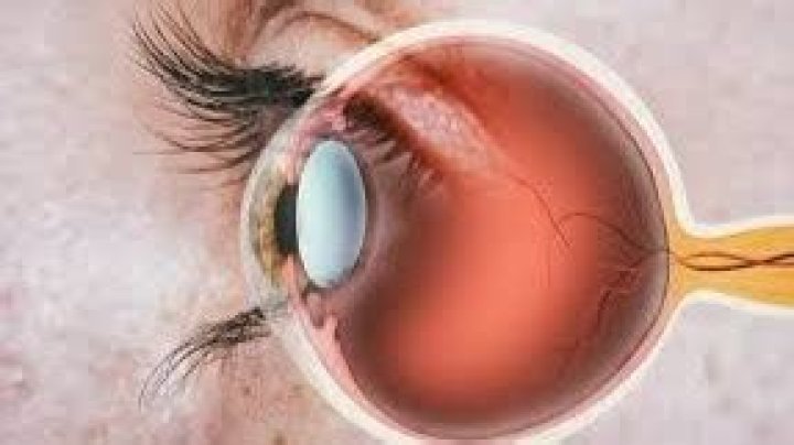 Can retinal damage be reversed?