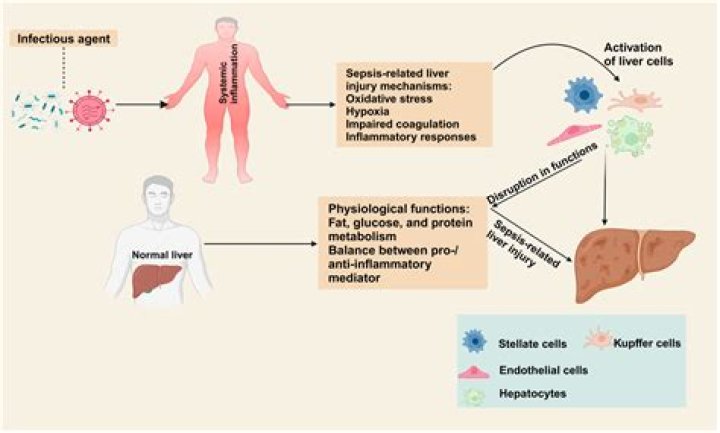 Can sepsis cause liver damage?