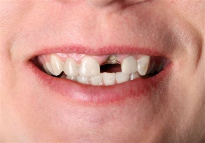 Can shaking teeth be fixed?