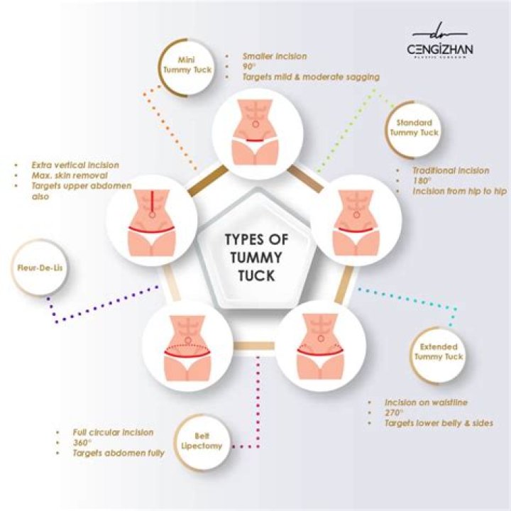 Can sneezing damage your tummy tuck?