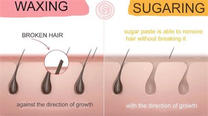 Can sugaring cause ingrown hairs?
