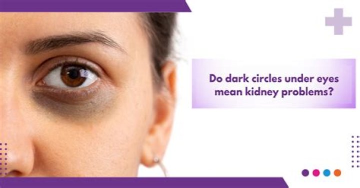 Can teenagers have dark circles?